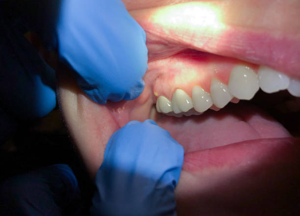 Best Urgent Tooth Repair  in Healdton, OK